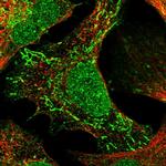 TNRC18 Polyclonal Antibody