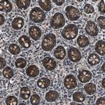 GGCT Polyclonal Antibody