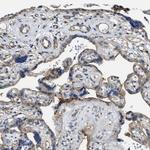 EndoGlyx-1 Antibody in Immunohistochemistry (IHC)