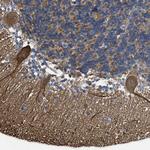 EndoGlyx-1 Antibody in Immunohistochemistry (IHC)