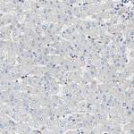 EndoGlyx-1 Antibody in Immunohistochemistry (IHC)