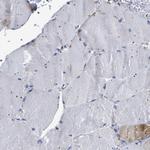 SQLE Antibody in Immunohistochemistry (Paraffin) (IHC (P))