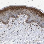 SQLE Polyclonal Antibody