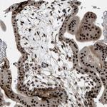 ZNF250 Antibody in Immunohistochemistry (Paraffin) (IHC (P))