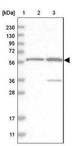 ZNF250 Antibody in Western Blot (WB)