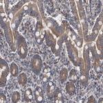 BCL2L12 Antibody in Immunohistochemistry (Paraffin) (IHC (P))