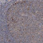 BCL2L12 Antibody in Immunohistochemistry (Paraffin) (IHC (P))