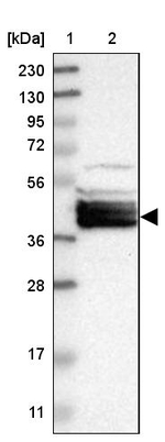 BCL2L12 Antibody in Western Blot (WB)