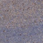 BCL2L12 Antibody in Immunohistochemistry (IHC)