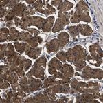 PPM1K Polyclonal Antibody