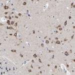 SRPK2 Antibody in Immunohistochemistry (Paraffin) (IHC (P))