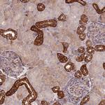 ZNF237 Antibody in Immunohistochemistry (Paraffin) (IHC (P))