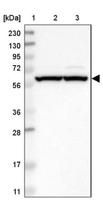 ZNF237 Antibody in Western Blot (WB)