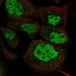 DPF2 Antibody in Immunocytochemistry (ICC/IF)