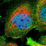 ZNF20 Antibody in Immunocytochemistry (ICC/IF)