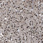 ZNF20 Antibody in Immunohistochemistry (Paraffin) (IHC (P))
