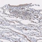 C9orf75 Antibody in Immunohistochemistry (Paraffin) (IHC (P))