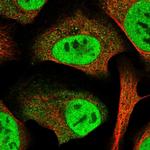 SERTAD2 Polyclonal Antibody