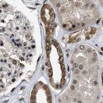 SERTAD2 Antibody in Immunohistochemistry (IHC)
