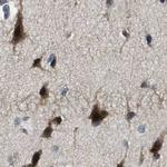 SERTAD2 Antibody in Immunohistochemistry (IHC)