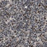 SERTAD2 Antibody in Immunohistochemistry (IHC)