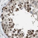 SERTAD2 Antibody in Immunohistochemistry (IHC)