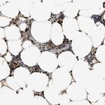 SERTAD2 Antibody in Immunohistochemistry (IHC)