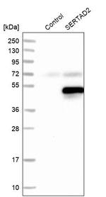 SERTAD2 Antibody in Western Blot (WB)