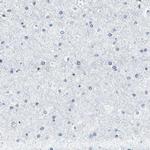 METTL1 Antibody in Immunohistochemistry (Paraffin) (IHC (P))