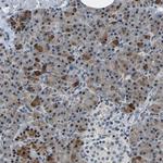 METTL1 Antibody in Immunohistochemistry (Paraffin) (IHC (P))