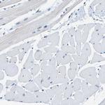 METTL1 Antibody in Immunohistochemistry (Paraffin) (IHC (P))