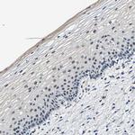 METTL1 Antibody in Immunohistochemistry (Paraffin) (IHC (P))