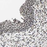 METTL1 Antibody in Immunohistochemistry (Paraffin) (IHC (P))