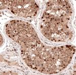 LMO7 Antibody in Immunohistochemistry (IHC)