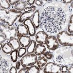 HINT2 Antibody in Immunohistochemistry (Paraffin) (IHC (P))
