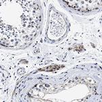 HINT2 Antibody in Immunohistochemistry (Paraffin) (IHC (P))