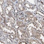 HAUS6 Antibody in Immunohistochemistry (Paraffin) (IHC (P))