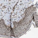 HAUS6 Antibody in Immunohistochemistry (Paraffin) (IHC (P))