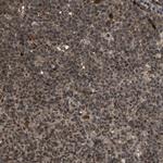 HAUS6 Antibody in Immunohistochemistry (Paraffin) (IHC (P))