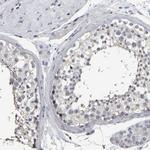 MURC Antibody in Immunohistochemistry (Paraffin) (IHC (P))