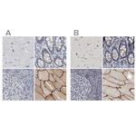 MURC Antibody in Immunohistochemistry (IHC)
