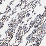 KLHDC5 Polyclonal Antibody