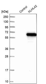 KLHDC5 Antibody in Western Blot (WB)