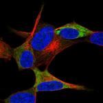 NACAD Polyclonal Antibody