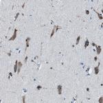 NACAD Antibody in Immunohistochemistry (IHC)