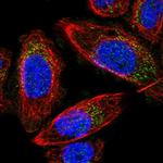 MRPS24 Polyclonal Antibody