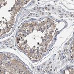 MURC Polyclonal Antibody