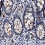MURC Antibody in Immunohistochemistry (IHC)
