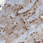 CSGlcAT Antibody in Immunohistochemistry (IHC)