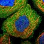 PLAA Polyclonal Antibody